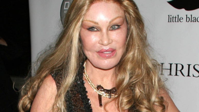 Jocelyn Wildenstein